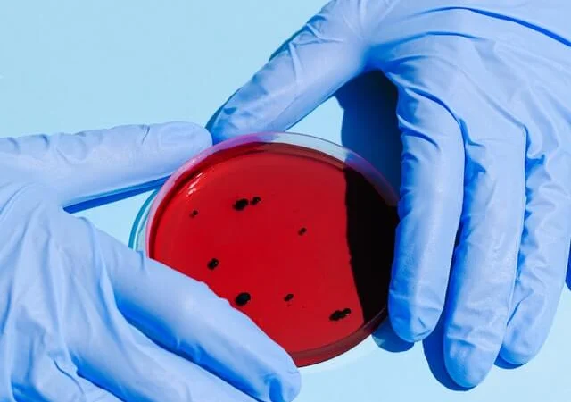 Laboratory sample handling